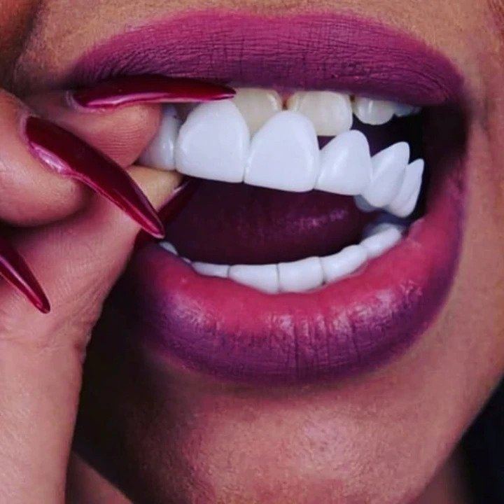 InstantSmile™ Gives you a fantastic smile